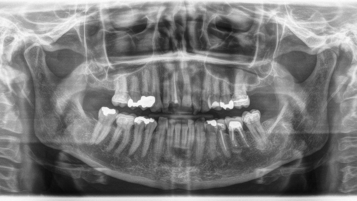 Dentsply Sirona RTG dijagnostika